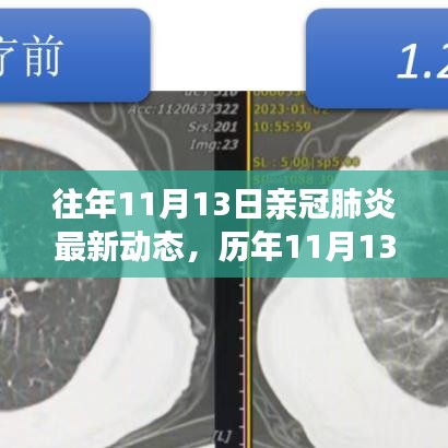 歷年11月13日新冠肺炎動(dòng)態(tài)回顧，最新進(jìn)展、當(dāng)前動(dòng)態(tài)與未來展望