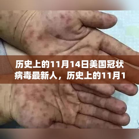 歷史上的11月14日，美國(guó)冠狀病毒最新進(jìn)展回顧與展望
