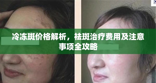 冷凍斑價(jià)格解析，祛斑治療費(fèi)用及注意事項(xiàng)全攻略
