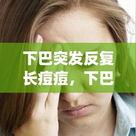 下巴突發(fā)反復長痘痘，下巴突發(fā)性長痘 