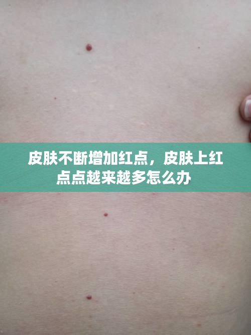 金石為開(kāi) 第2頁(yè)
