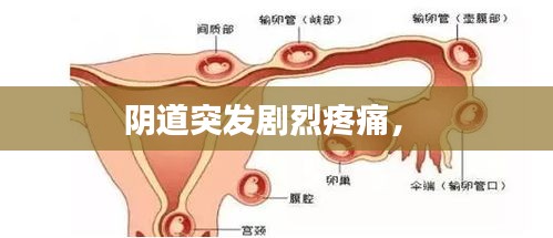 陰道突發(fā)劇烈疼痛， 