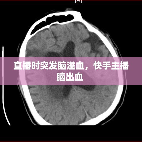 直播時突發(fā)腦溢血，快手主播腦出血 