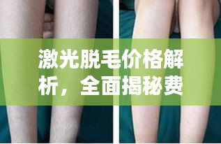 激光脫毛價格解析，全面揭秘費用因素！