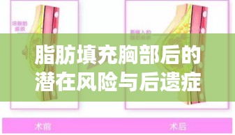 脂肪填充胸部后的潛在風(fēng)險(xiǎn)與后遺癥解析