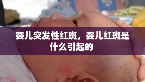 嬰兒突發(fā)性紅斑，嬰兒紅斑是什么引起的 