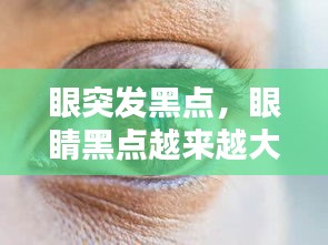 眼突發(fā)黑點(diǎn)，眼睛黑點(diǎn)越來越大 
