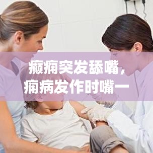 癲癇突發(fā)舔嘴，癇病發(fā)作時嘴一直在咀嚼 