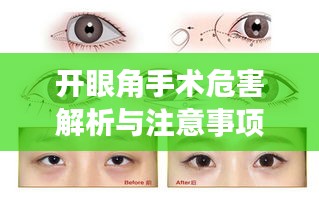 開眼角手術(shù)危害解析與注意事項指南——百度健康知識分享